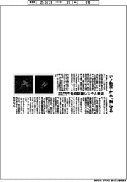 精神・神経医療研究センター、ナノ粒子から「脳」守る 免疫防御システム発見