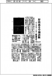 大阪公立大、肝疾患を早期診断 バイオマーカー候補発見