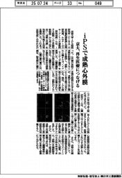 京大、iPSで成熟心外膜 再生医療につなげる