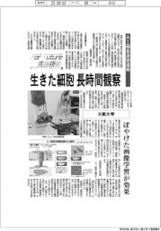 For Future先端技術(169)大阪大学 AI超音波望遠鏡