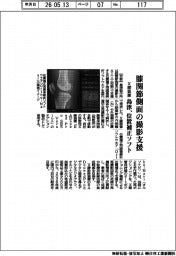 島津製作所、膝関節側面の撮影支援 X線装置 位置補正ソフト