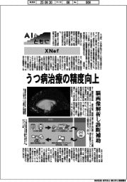 ＡＩとともに／ＸＮｅｆ　うつ病治療の精度向上