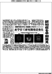 点描／認知症を早期発見　蓄積予測モデル・検査薬・PET　産学官で研究開発活発化