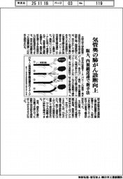 阪大、気管奥の肺がん診断向上　内視鏡送達で新手法
