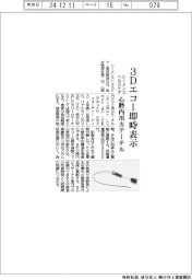 シーメンスヘルスケア、3Dエコー即時表示 心腔内用カテーテル