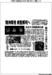 ニュース拡大鏡／ＱＳＴ、精神障害病態解明へ　早期発見に道